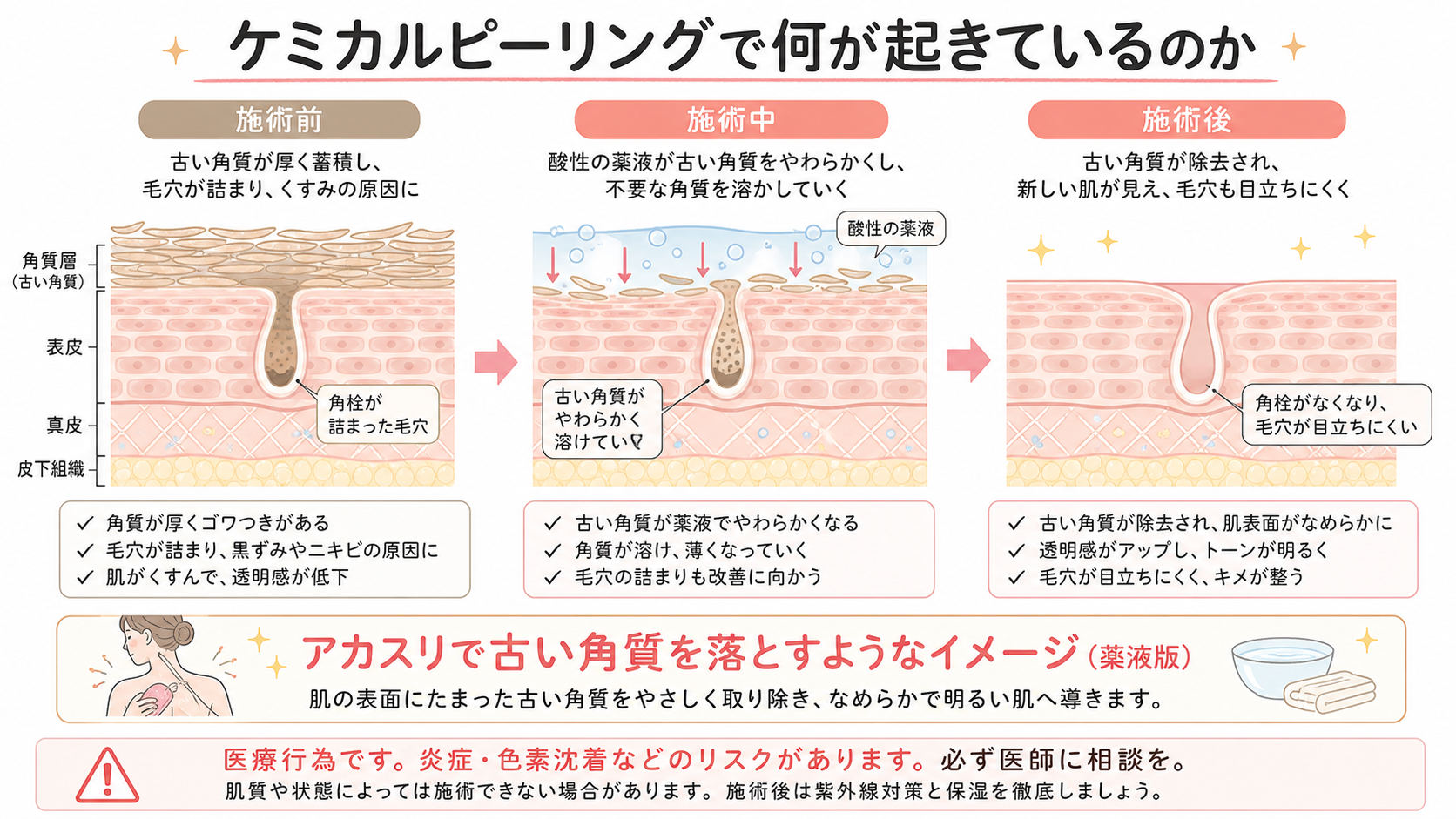 peeling_mechanism