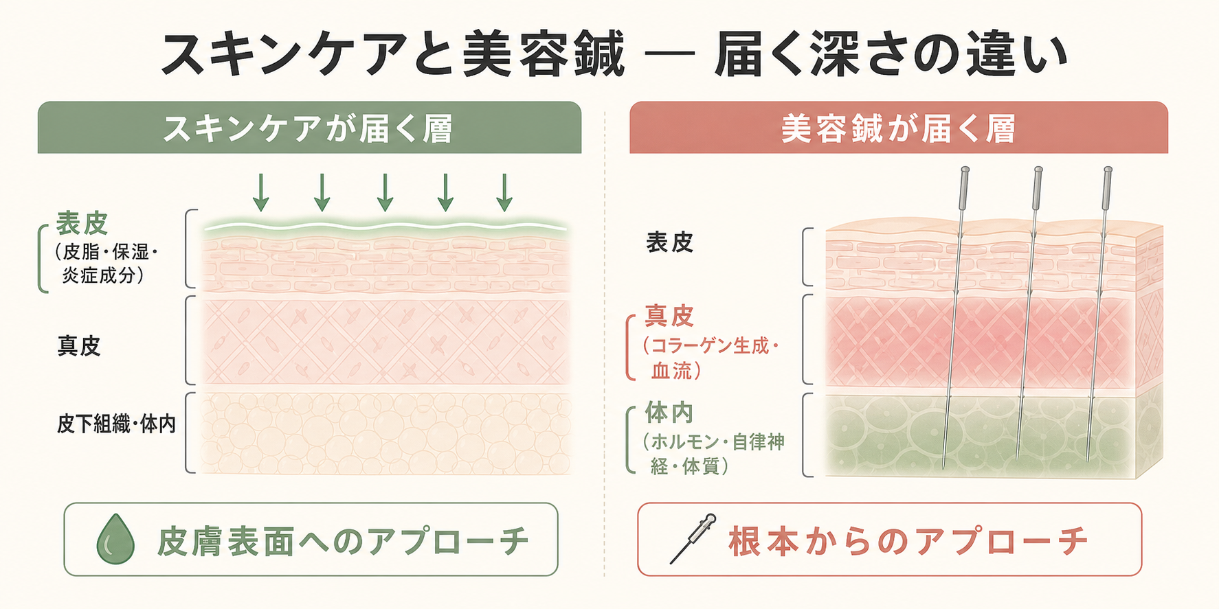 記事30_美容鍼-ニキビ-効果_画像30-2_スキンケアvs美容鍼の届く層比較図.png